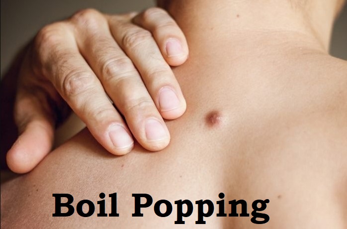Boil Popping